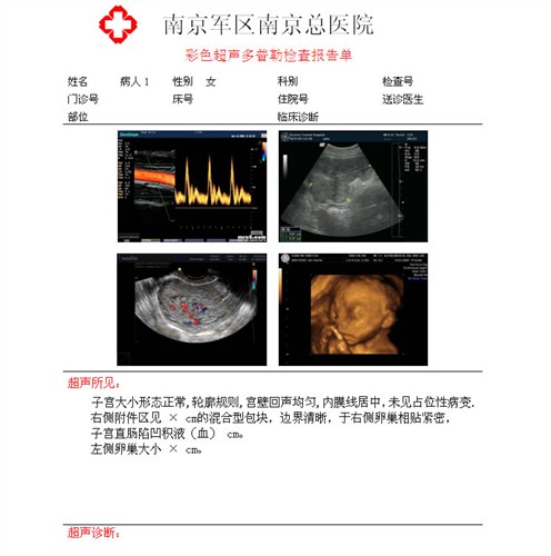 國產膠片 醫用膠片生產廠家 安徽膠片廠家 菲力姆供-- 合肥菲力姆科技有限公司